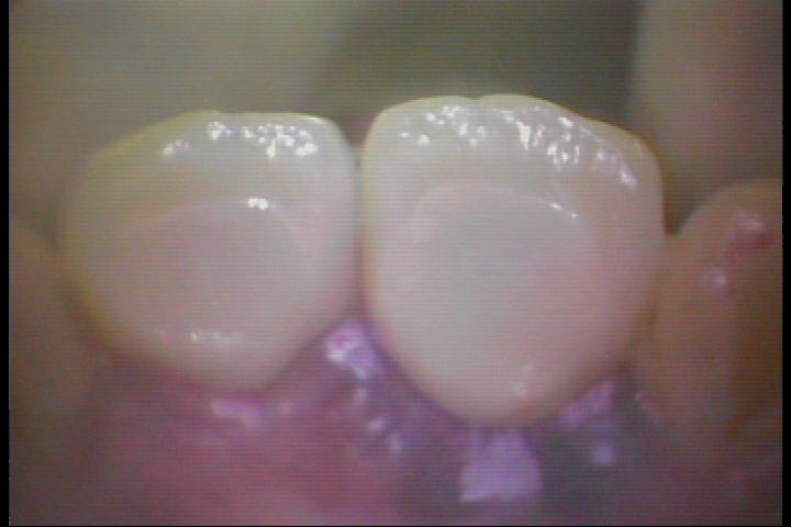 PICT0045