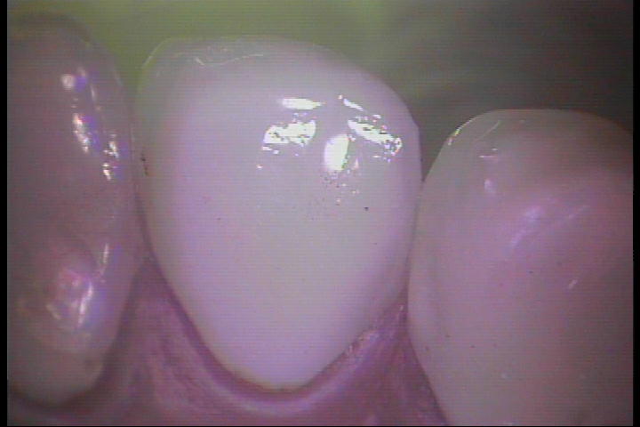 PICT0039
