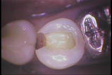 PICT0014