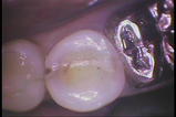 PICT0011