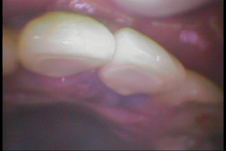 PICT0051
