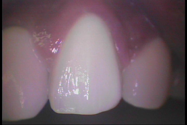 PICT0038