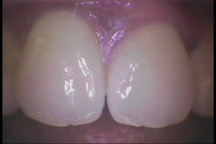 PICT0044