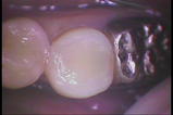 PICT0015
