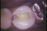 PICT0013