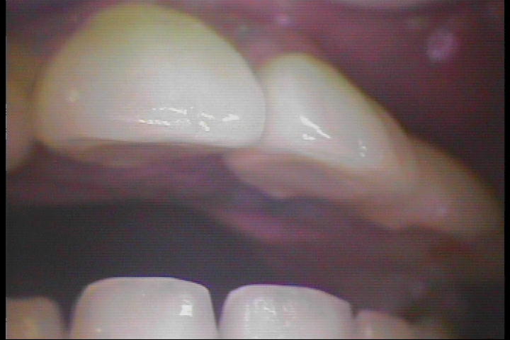 PICT0049
