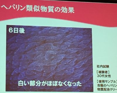 IMG_3622 (400x319)