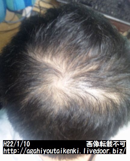 220110