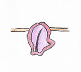 赤にきび