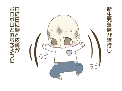 073 新生児落屑がさらに進行 ぴぷめわん家族 年子男女の子育ては大変 時短アイテムでガンガン手抜き