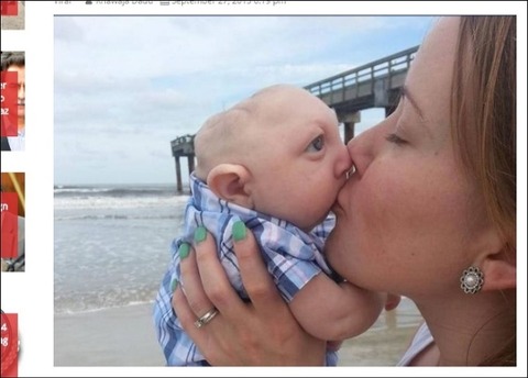 microhydranencephaly_4_thum630