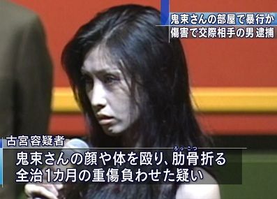 鬼束ちひろ-激変-理由-DV