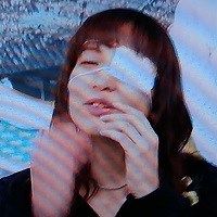 鈴木杏樹眼帯