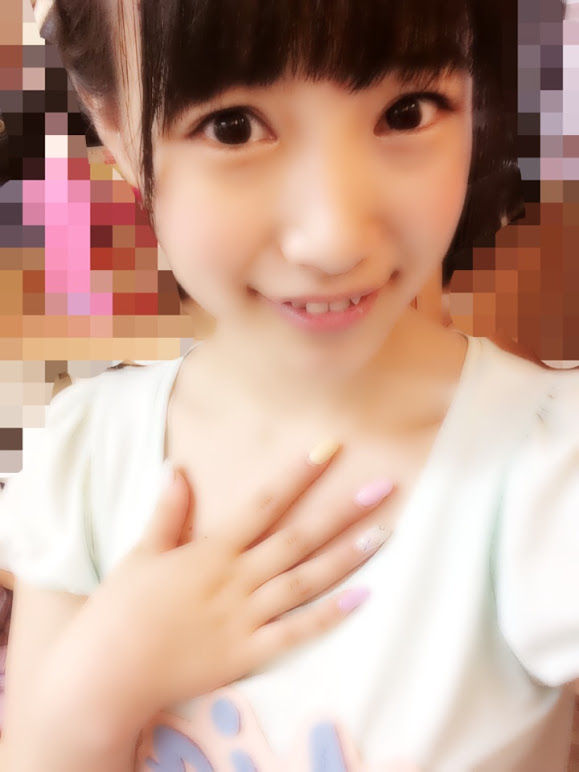 140621mio02