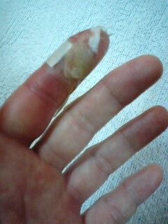 昨夜 ネズミに噛まれて ちゅうちゅうちゅう