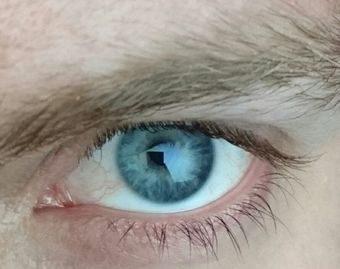 1502295462466