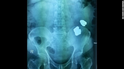 gold-bars-0422-horizontal-gallery