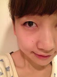 images(2)
