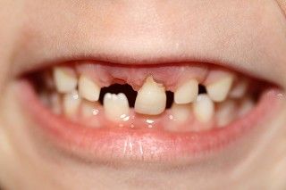 Tenacious-Tooth_s