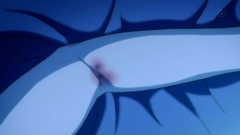 ancb00044