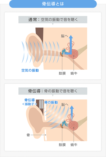 type-bone-conduction_01