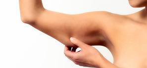flabbyarms