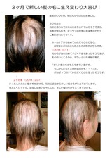 ３ヶ月で新しい髪の毛に・・（ｃｏｃｏ、ｍ）0001
