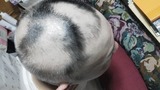中野育毛３