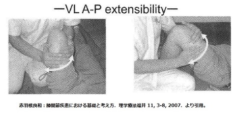 VL exensibility