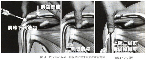 注射部位