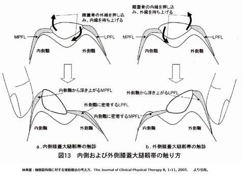膝蓋大腿靭帯ストレッチ