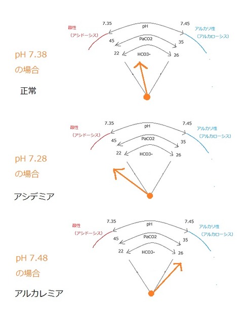 血液ガスの見方 pH