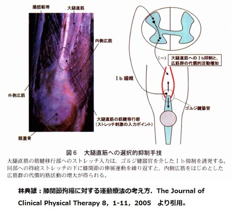 大腿直筋の抑制