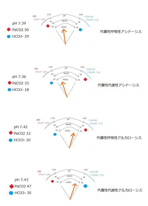 血液ガスの見方 代償②