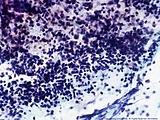 270_sputum-s