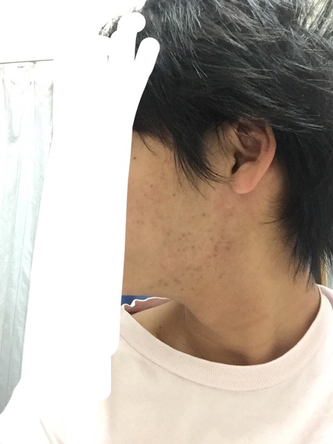 Xv5nnKF