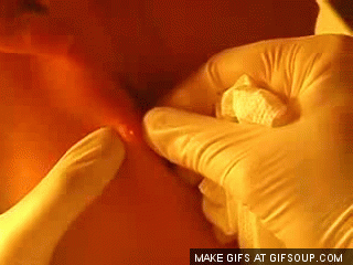 spot-gif-31