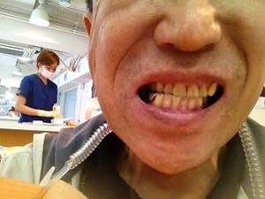 今日は歯のお掃除