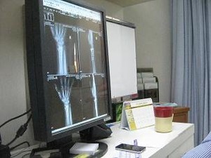 術後3ヶ月