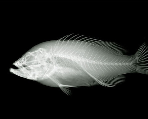 amazing_xray_artwork_640_13