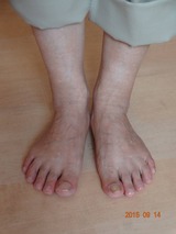 足指