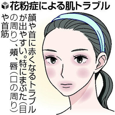 元気なう 花粉症に負けるな ２ 肌に付くと炎症 あつ花blog