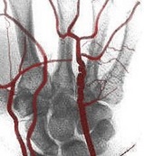 e5
