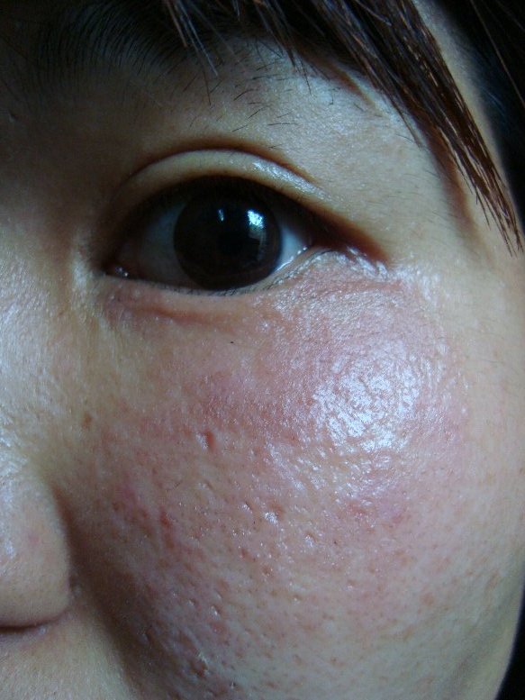 光アレルギー 花粉症の季節が近づくと憂鬱になってしまう人に役立つ 花粉症に関する本のおすすめ3選 News News ニュース