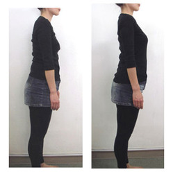 befor-after
