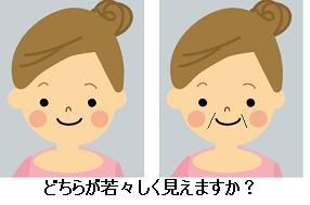 ほうれい線