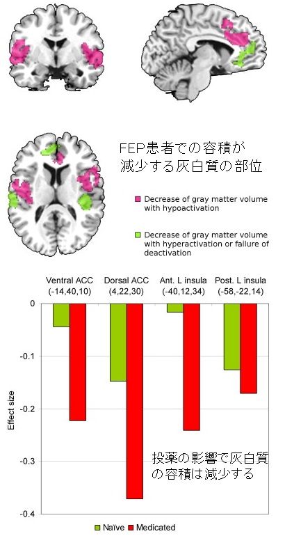 grey matter change-6