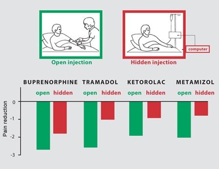 open vs hidden