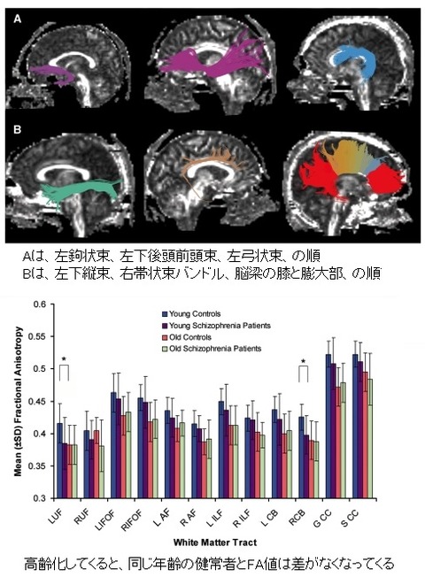 white matter change-20