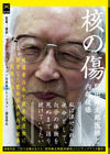 120616kakunokizu